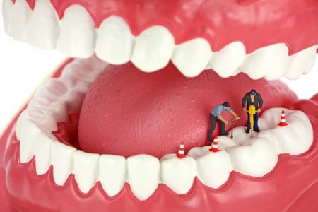 Zähne werden behandelt